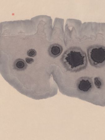 Study N°7 | Epidermis